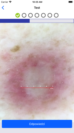 Testy Akademia Dermatoskopii(圖1)-速報App