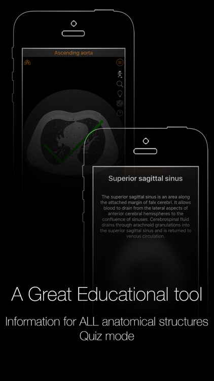 CT Anatomy