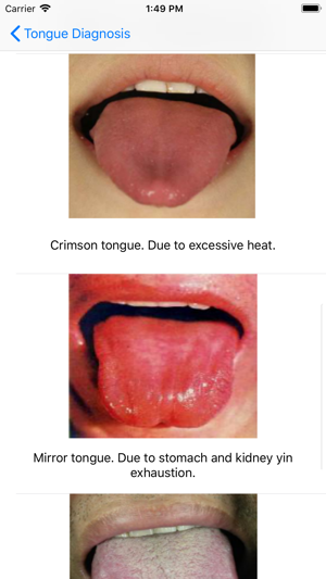 Tongue Diagnosis(圖3)-速報App