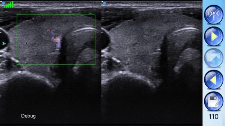 SIUI PIE-3 screenshot-3