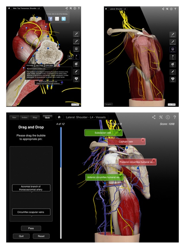 Shoulder Pro III for iPad(圖5)-速報App