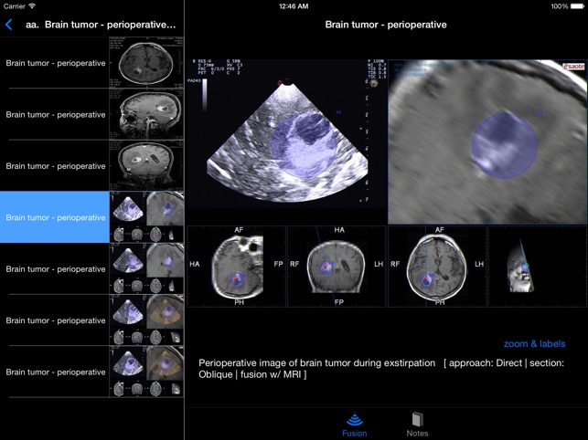 Sonographic Brain Atlas(圖5)-速報App