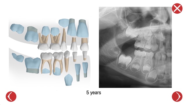 Dental Corpus Primary(圖3)-速報App