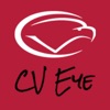 CV Eye