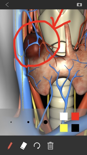 Thyroid Navigator(圖3)-速報App