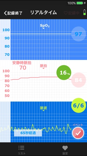 NISSEI MP-1000NET(圖1)-速報App