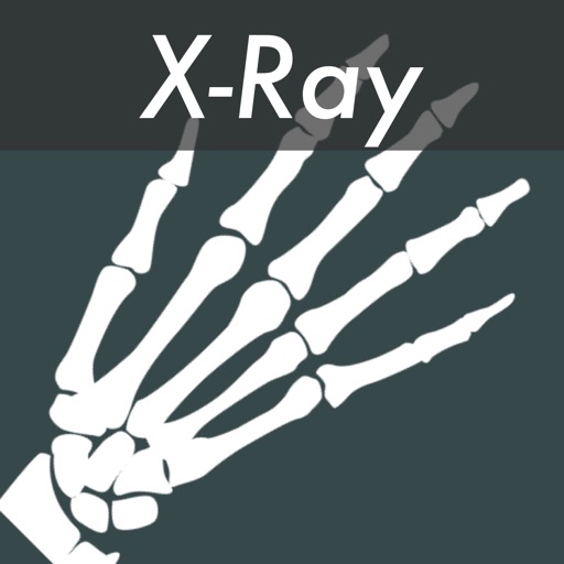 X-Ray Photo Effects iOS App