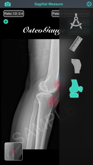 量腳器 - OsteoGauge