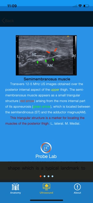 MSK Ultrasound: Thigh(圖4)-速報App