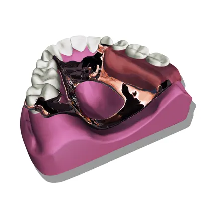 Removable Partial Dentures Читы