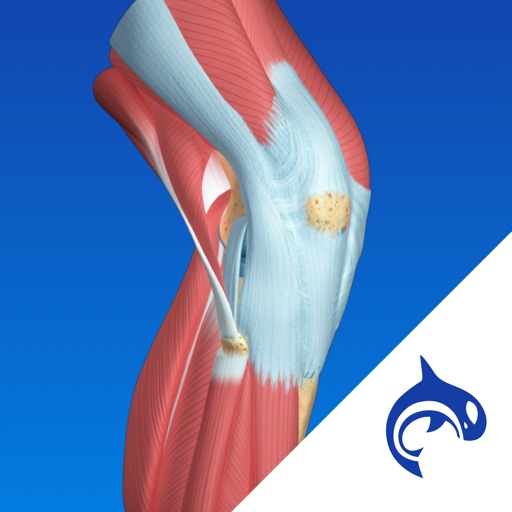 Knee Decide iOS App