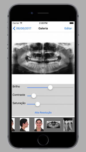 All Doc Radiologia(圖3)-速報App