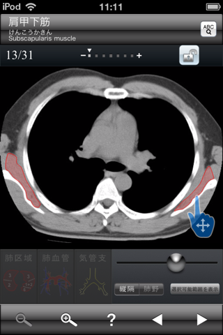 断面図ウォーカー胸部CT screenshot 2