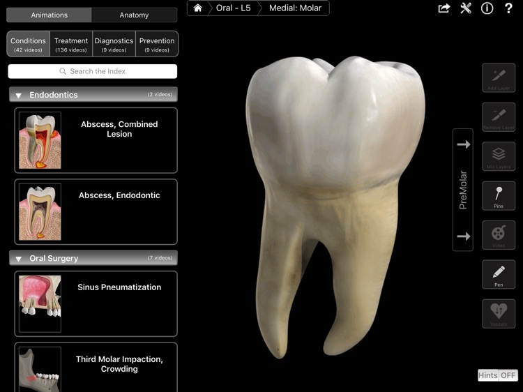 Dental Patient Education screenshot-0