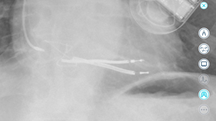 Cardiac Device Challenge screenshot-3
