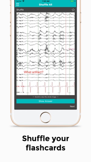 EEG(圖5)-速報App