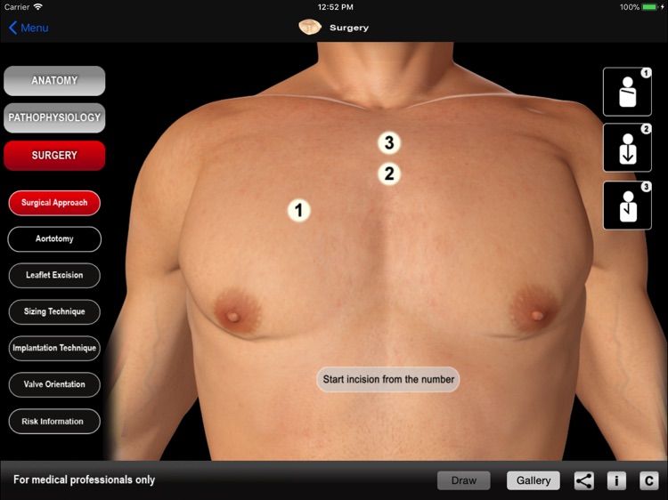 HEART MASTER Aortic Stenosis