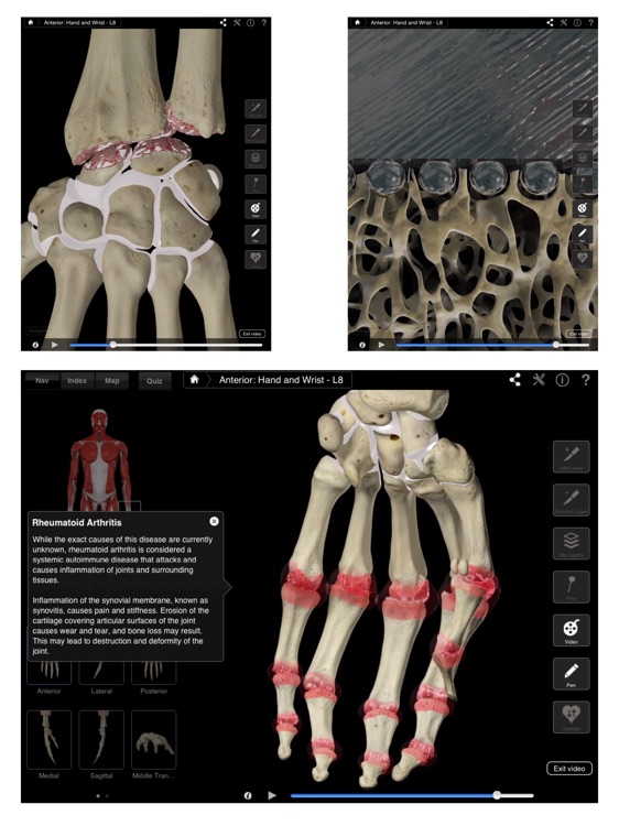 Hand & Wrist Pro III for iPad