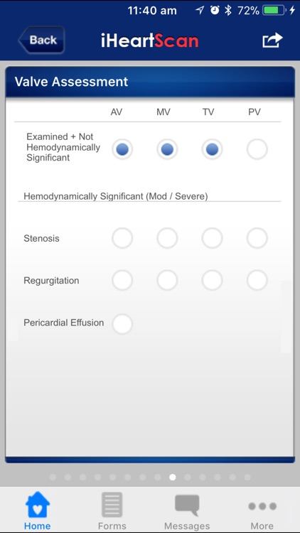 iHeartScan