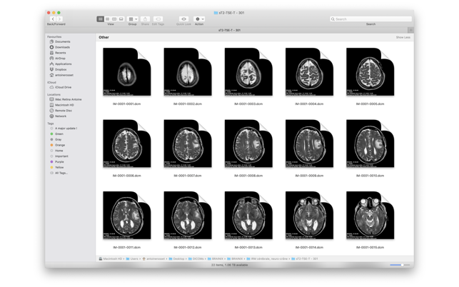 DICOM Quicklook by OsiriX(圖2)-速報App