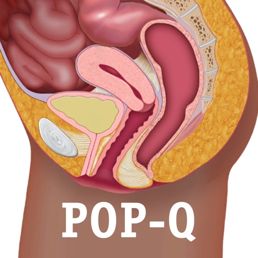 Pop-Q
