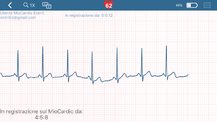 MioCardio Viewer