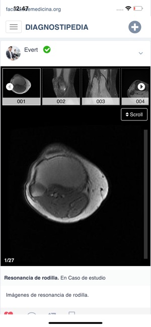 DIAGNOSTIPEDIA(圖5)-速報App