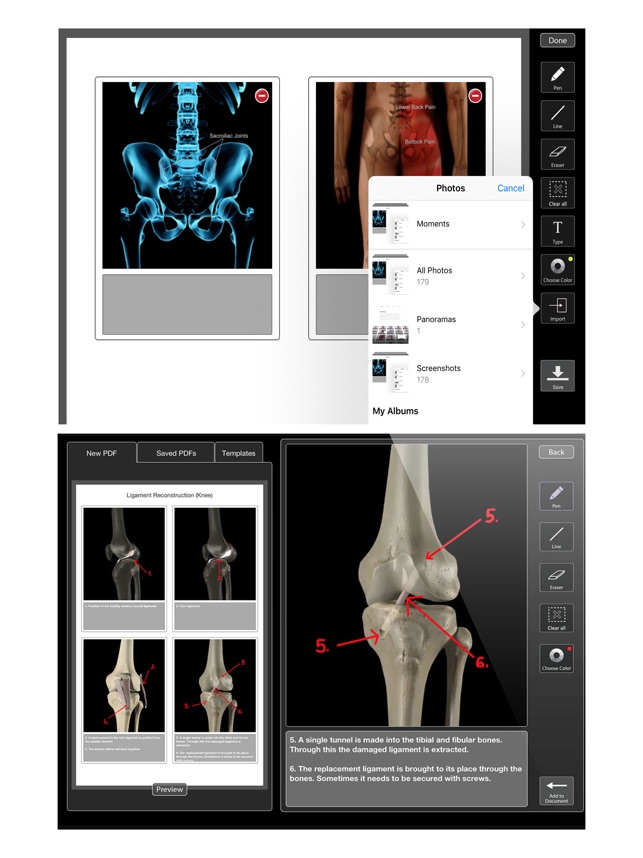 Orthopedic Patient Education(圖3)-速報App