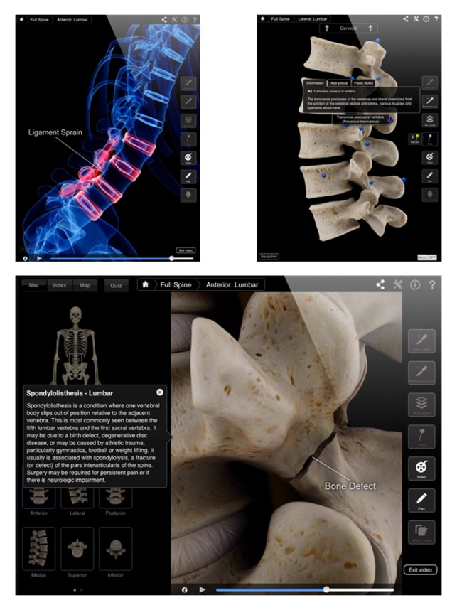 Spine Pro III(圖4)-速報App