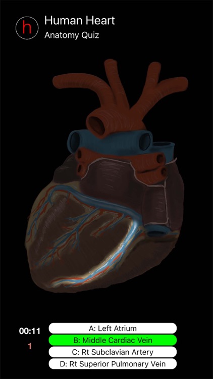 Human Heart Anatomy Quiz screenshot-3