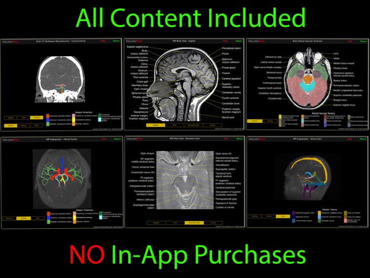 NeuroRad