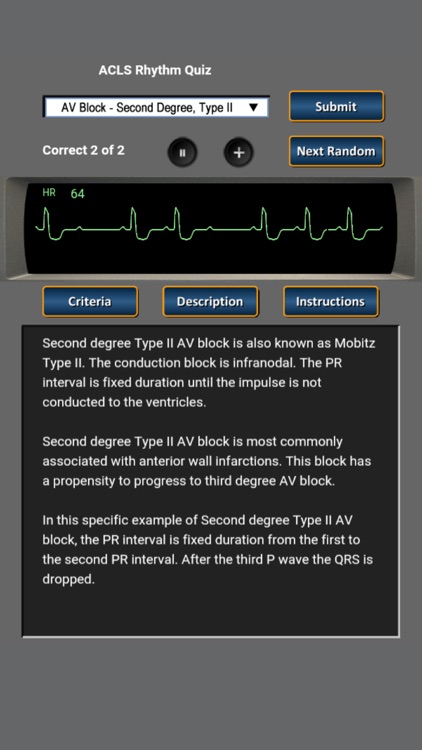 ACLS Rhythm Quiz screenshot-3