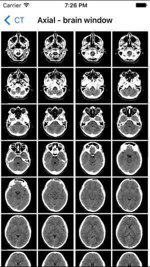 Brain Images(圖5)-速報App