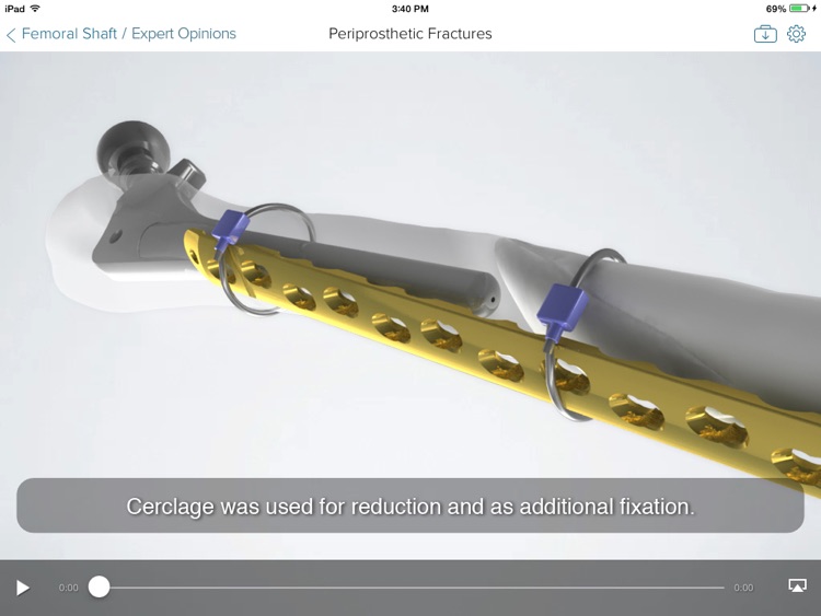 ICUC screenshot-3
