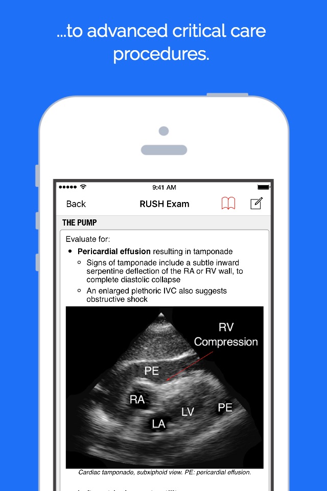 palmEM: EM Quick Reference Aid screenshot 3