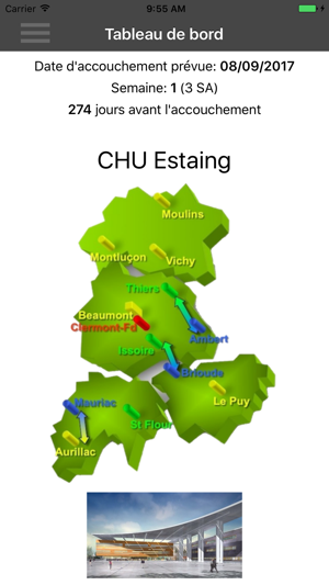 RSPA - CHU Estaing(圖1)-速報App