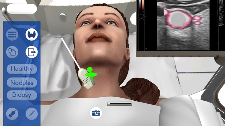 USCAP Thyroid Biopsy Sim