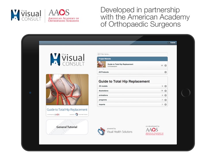 The Visual Consult: Hip Replacement