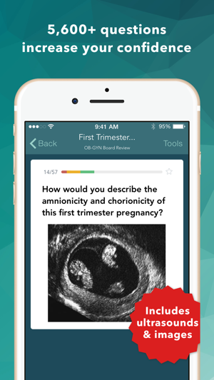 Ob Gyn Board Review Flashcards(圖1)-速報App