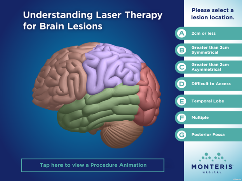 Laser Therapy for Brain Lesions - iPad Version screenshot 2