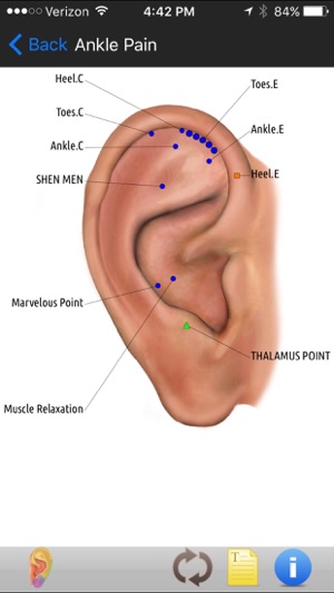 Auriculo(圖4)-速報App