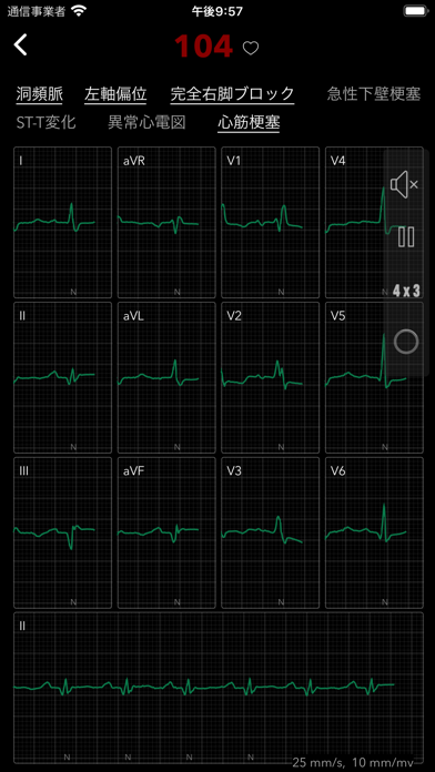 ECG Pro for Doctors screenshot1