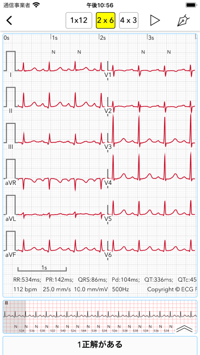 ECG Test Pro screenshot1