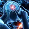 Icon Neurology Quiz