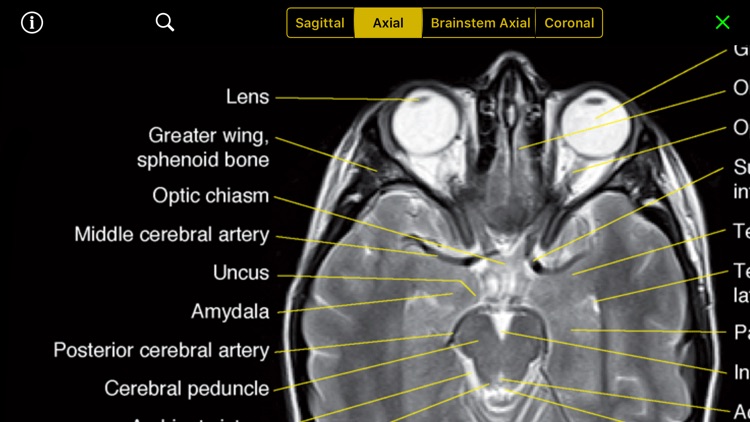 NeuroRad Mini