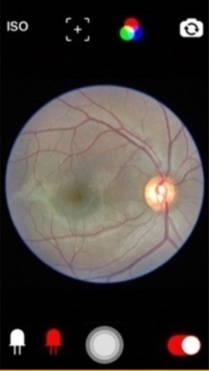 Fundus Cam(圖1)-速報App