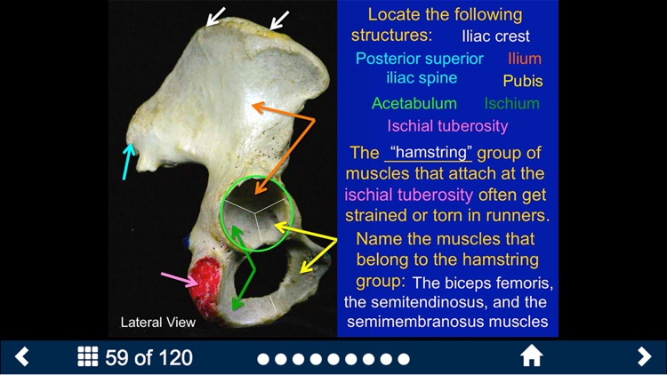 MSK Anatomy - SecondLook screenshot-4