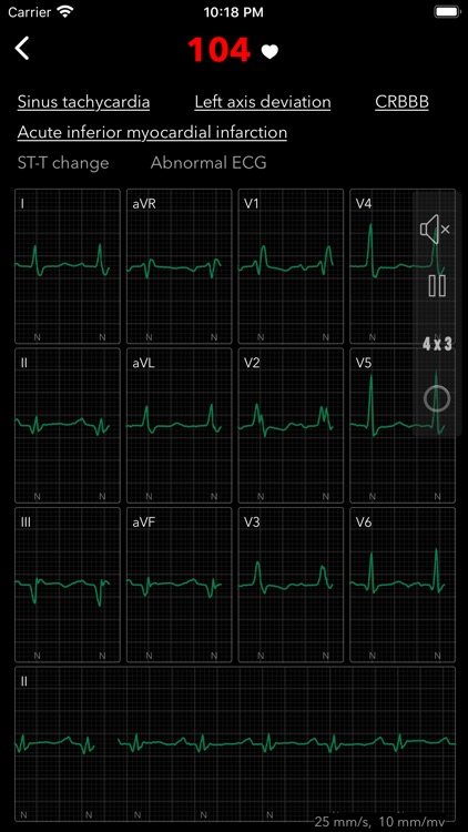 ECG Pro for Doctors screenshot-4