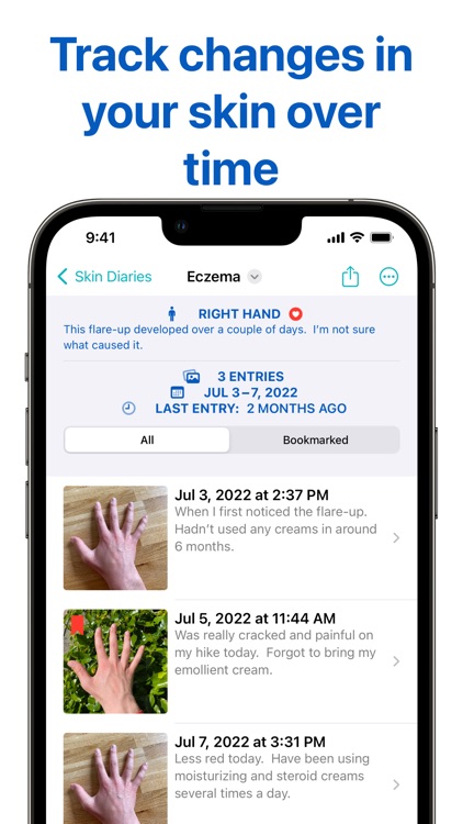 Derm Diary: Skin Tracker