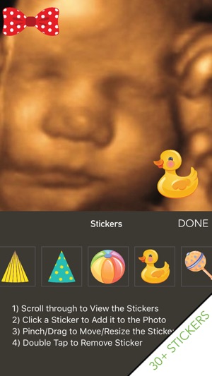 Stork Vision Ultrasound Photo Booth(圖3)-速報App